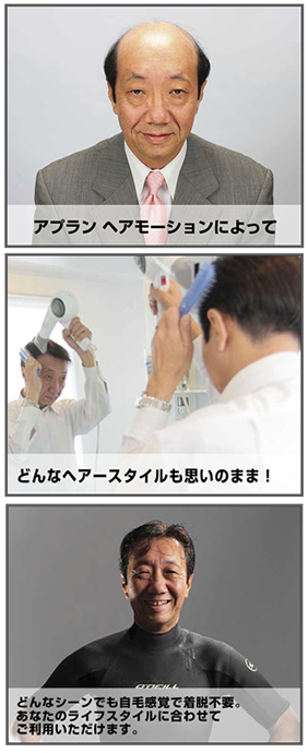 Activeな おとこに贈るまったく新しい増毛 アプランヘアモーション 9月日発売 株式会社 東京義髪整形のプレスリリース