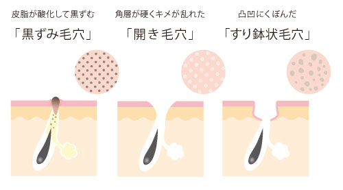 史上初 うぶ毛と毛穴が同時にケアできる化粧品 あの人気の パイナップル豆乳シリーズ から革新的な うぶ毛穴ケア 誕生 株式会社鈴木ハーブ研究所のプレスリリース 史上初 うぶ毛と毛穴が同時にケアできる化粧品 あの人気の パイナップル豆乳シリーズ から革新的な うぶ毛穴ケア 誕生 株式会社鈴木ハーブ研究所のプレスリリース