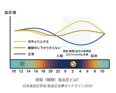 株式会社エー・アンド・デイのプレスリリース画像1