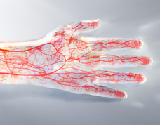 株式会社MTGのプレスリリース画像4