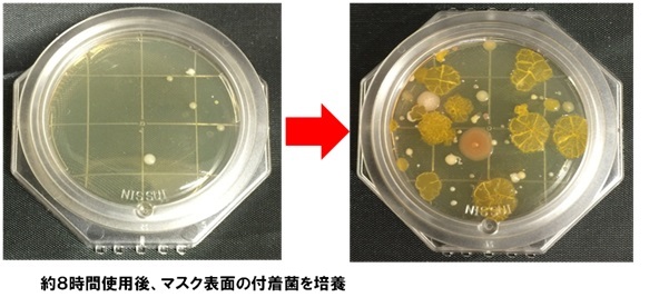 エーザイ株式会社のプレスリリース画像3