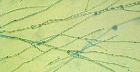 野田食菌工業株式会社のプレスリリース画像3