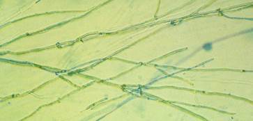 野田食菌工業株式会社のプレスリリース画像6