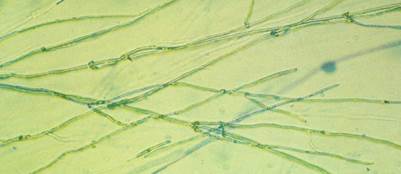 野田食菌工業株式会社のプレスリリース画像4