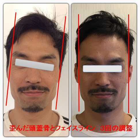 パワーマグネット整体院（生体磁気カイロプラクティック）のプレスリリース画像2