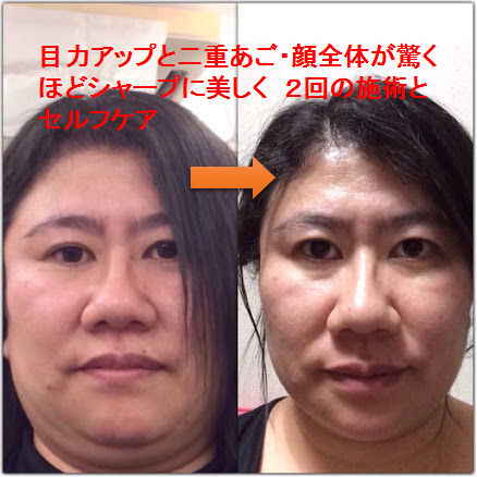 パワーマグネット整体院（生体磁気カイロプラクティック）のプレスリリース画像6