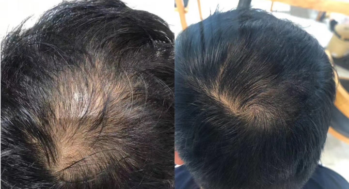 熱く信頼される 髪の毛に悩む女性のためのサプリ Volume Care ボリュームケア とは 株式会社ローズクリエイトのプレスリリース 熱く信頼される 髪の毛に悩む女性のためのサプリ Volume Care ボリュームケア とは 株式会社ローズクリエイトのプレスリリース