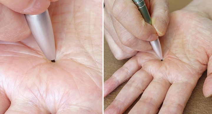 ご自身で悪い手相を変える 世界でも類を見ない 手相を変える前と後の比較画像を公開 Cosmic Noah ペン型 手相障害線除去器具 株式会社ローズクリエイトのプレスリリース